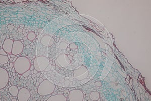 Cross-section Dicot, Monocot and Root of Plant Stem under the microscope.