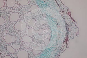 Cross-section Dicot, Monocot and Root of Plant Stem under the microscope.