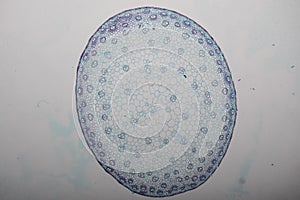 Cross-section Dicot, Monocot and Root of Plant Stem under the microscope.