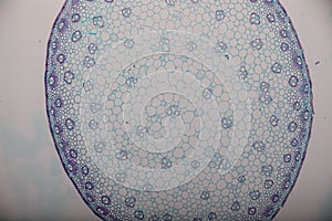 Cross-section Dicot, Monocot and Root of Plant Stem under the microscope.