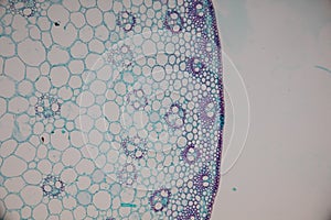 Cross-section Dicot, Monocot and Root of Plant Stem under the microscope.