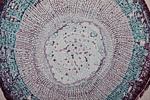 Cross-section Dicot, Monocot and Root of Plant Stem under the microscope.