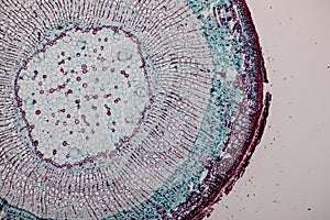 Cross-section Dicot, Monocot and Root of Plant Stem under the microscope.