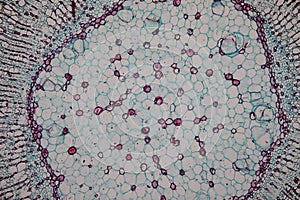 Cross-section Dicot, Monocot and Root of Plant Stem under the microscope.