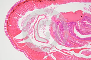 Section of an Earthworm under the microscope