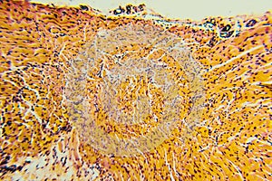 Cross section esophagus dog