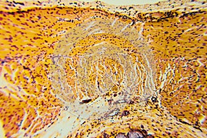 Cross section esophagus dog