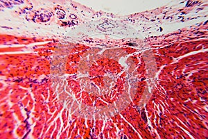 Cross section esophagus dog