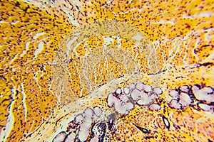 Cross section esophagus dog