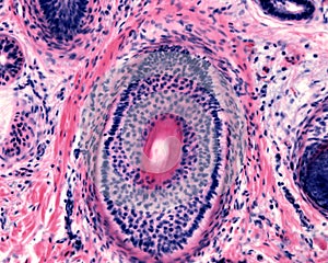 Human hair follicle photo