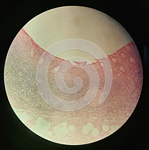 Cross section through a human appendix