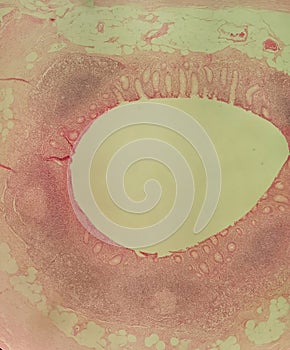 Cross section through a human appendix