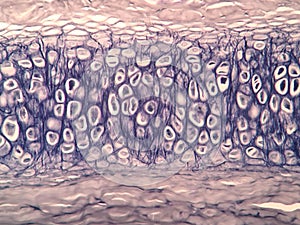 Cross section human cartilage bone