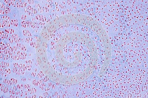 Cross section human cartilage bone under microscope view