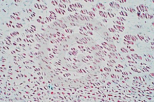 Cross section human cartilage bone under microscope view
