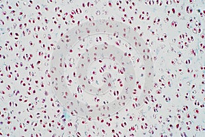 Cross section human cartilage bone under microscope view