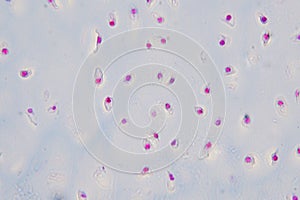 Cross section human cartilage bone under microscope view for education histology.