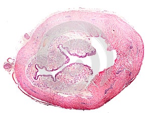 Cross-section of human esophagus