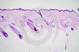 Cross section human skin head under microscope view for education histology.