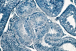 Cross section Human testis under microscope view.