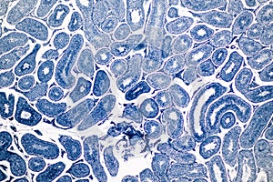 Cross section Human testis under microscope view.