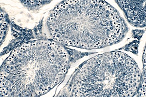 Cross section Human testis under microscope view photo