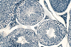 Cross section Human testis under microscope view photo