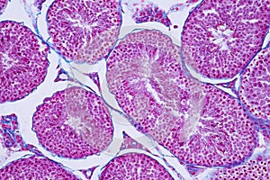Cross section Human testis under microscope view for education h photo