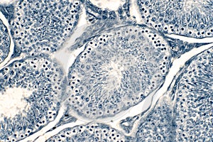 Cross section Human testis under microscope view photo