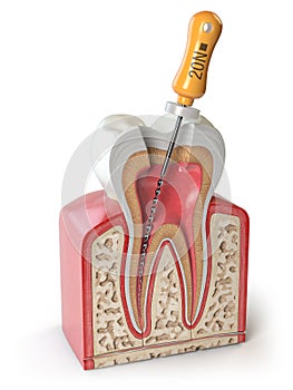 Cross section of Human tooth with endodontic file isolated on white