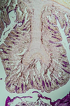 Cross-section through the intestine with glands