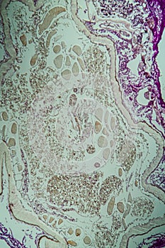 Cross-section through the intestine with glands