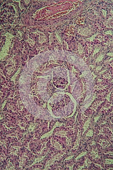 Cross section of the kidney with Glumeroli