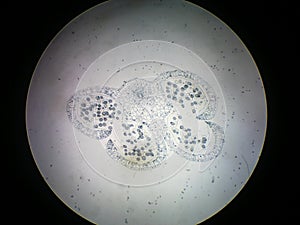 cross section of a lily anther.