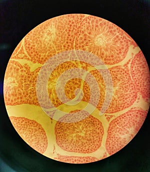 Cross Section of Male Testis