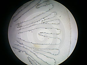 Cross section of mushroom