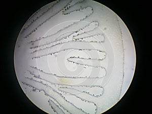 Cross section of mushroom