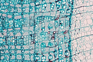 Cross section - Phloem is a type of tissue in vascular plants that transports water and some nutrients