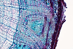 Cross section - Phloem is a type of tissue in vascular plants that transports water and some nutrients photo