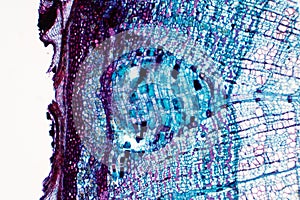 Cross section - Phloem is a type of tissue in vascular plants that transports water and some nutrients photo