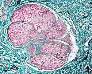 Human skin. Pilosebaceous unit photo