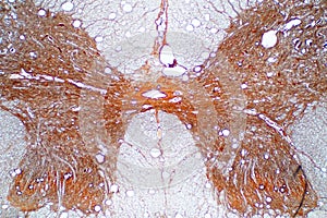 Cross section of spinal cord under the microscope view.