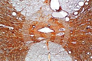 Cross section of spinal cord under the microscope view.