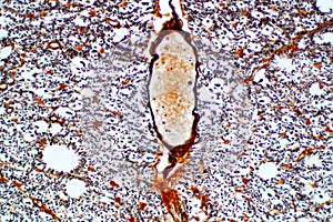 Cross section of spinal cord under the microscope view.