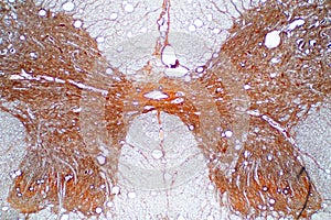 Attraverso sezione da spinale cordone microscopio 