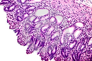 Cross section of stomach