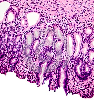 Cross section of stomach