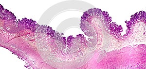 Cross section of stomach. Light micrograph showing stomach epithelium