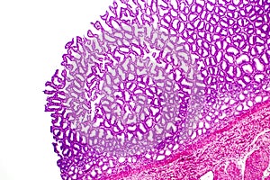 Cross section of stomach. Light micrograph showing stomach epithelium