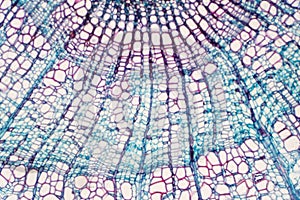 Cross section - Xylem is a type of tissue in vascular plants that transports water and some nutrients photo